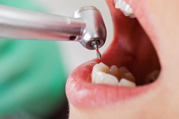 Best Emergency Dentist for Knocked-Out Tooth in Leavittsburg, OH
